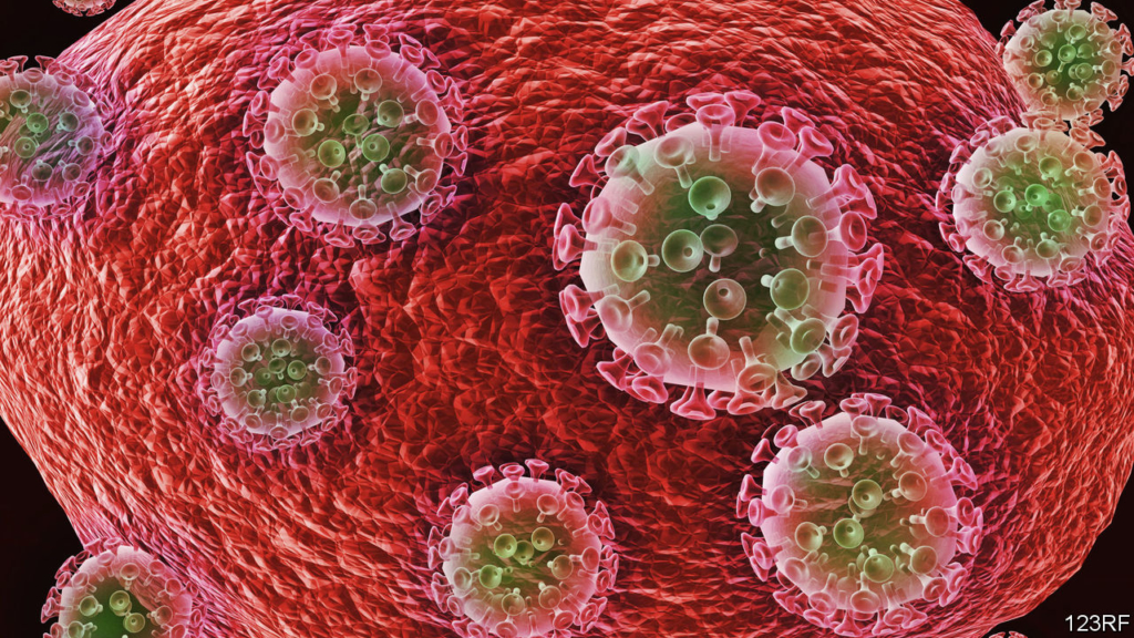 A second person has probably been cured of HIV