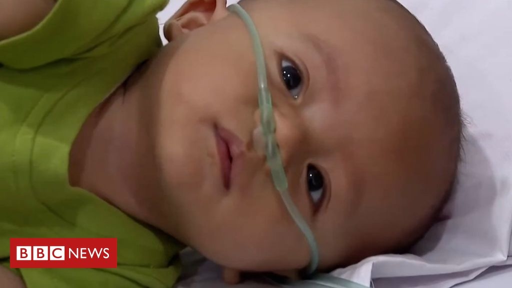 ‘I’m worried about my baby’s health’