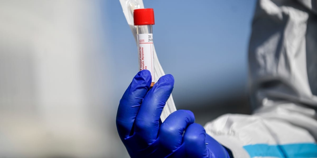 Wealthy Americans are paying for in-home coronavirus tests – Business Insider