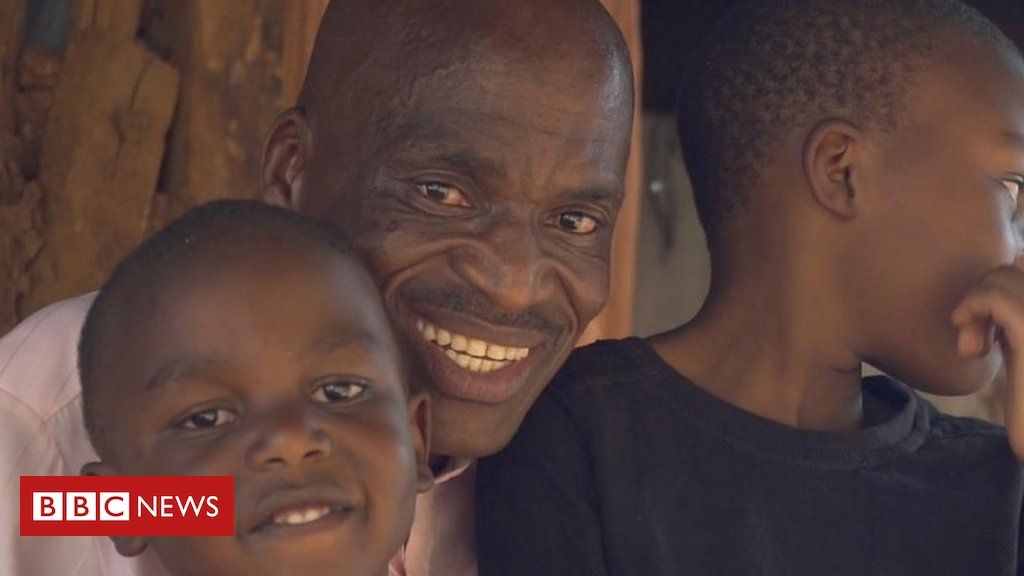 ‘It’s easy to get infected here’