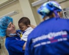 Understanding the challenges of living with a cleft lip | Letters understanding-the-challenges-of-living-with-a-cleft-lip-|-letters